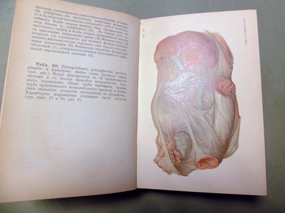 Шеффер О. Карманный медицинский атлас.Том III. Атлас и Краткие основы Гинекологии.