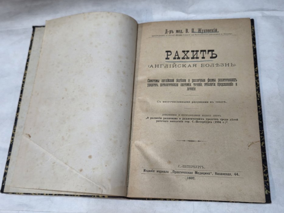 Жуковский В. П., д-р мед. Рахит (английская болезнь).