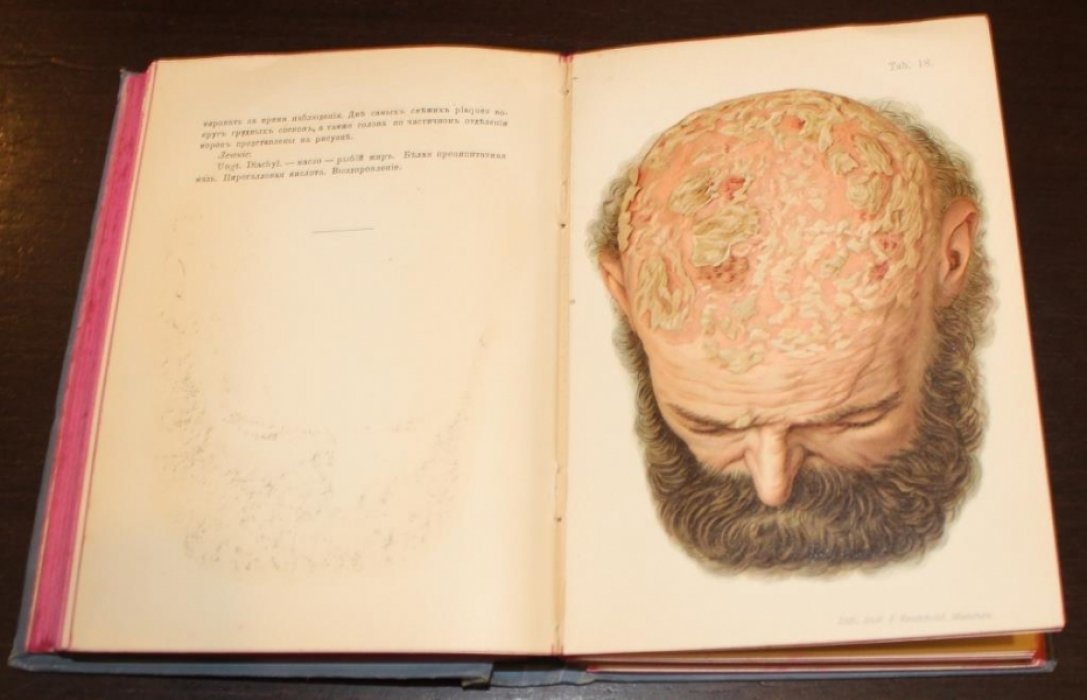 Prof. Dr. Franz Mracek Карманный медицинский атлас. Том 15. Атлас кожных болезней с кратким очерком патологий и терапии их